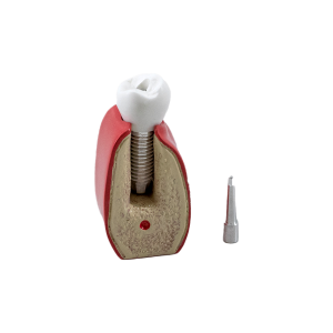 MACRO MODELO UNITÁRIO - PARAFUSADO (HI) - cód. 9874