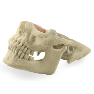 MANEQUIM COM ASSIMETRIA FACIAL SEVERA - cód. 12789