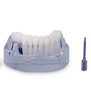 MANDÍBULA ACRÍLICA COM DENTES E 3 IMPLANTES - cód. 9570