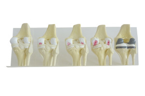 KIT DE JOELHOS COM OSTEOARTRITE - 5 PEÇAS - cód. 9597